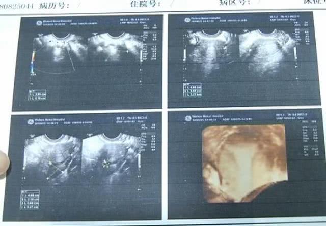 未婚女孩月经一直不干净怎么回事,21岁未婚女孩月经不调