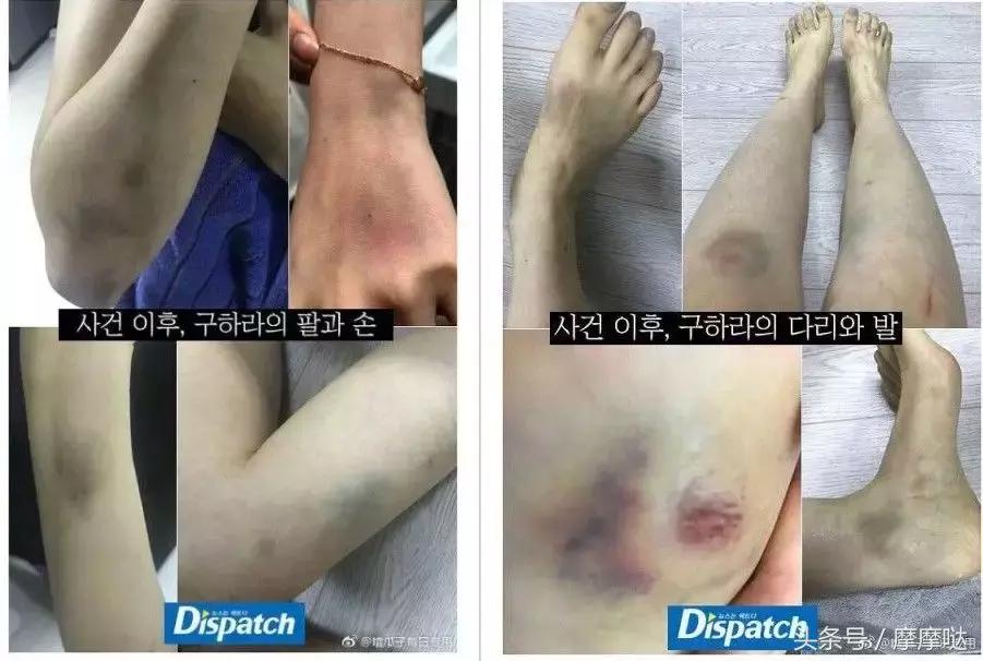 女艺人被男友用*爱性**视频威胁：还有多少人在用舆论给罪犯脱罪？