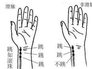 诊脉的方法,中医诊脉最简单方法