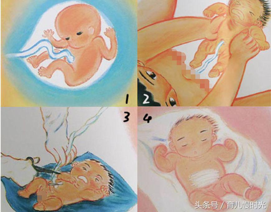 治消化不良腹泻的肚脐贴,婴儿腹泻呕吐用什么肚脐贴好