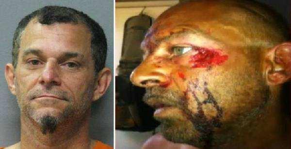 第三代*品毒**之夫拉卡（Flakka），人称“丧尸浴盐”*品毒**第二代