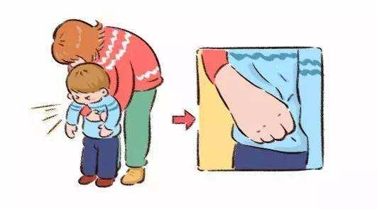 孩子异物卡喉急救后窒息了怎么办,婴儿异物卡喉急救方法和注意事项