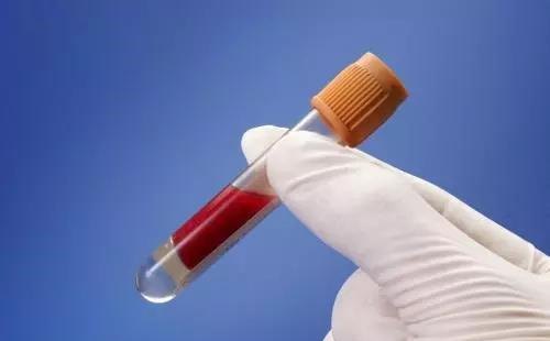 怎么看乙肝抗病毒治疗效果,乙肝抗病毒药评价