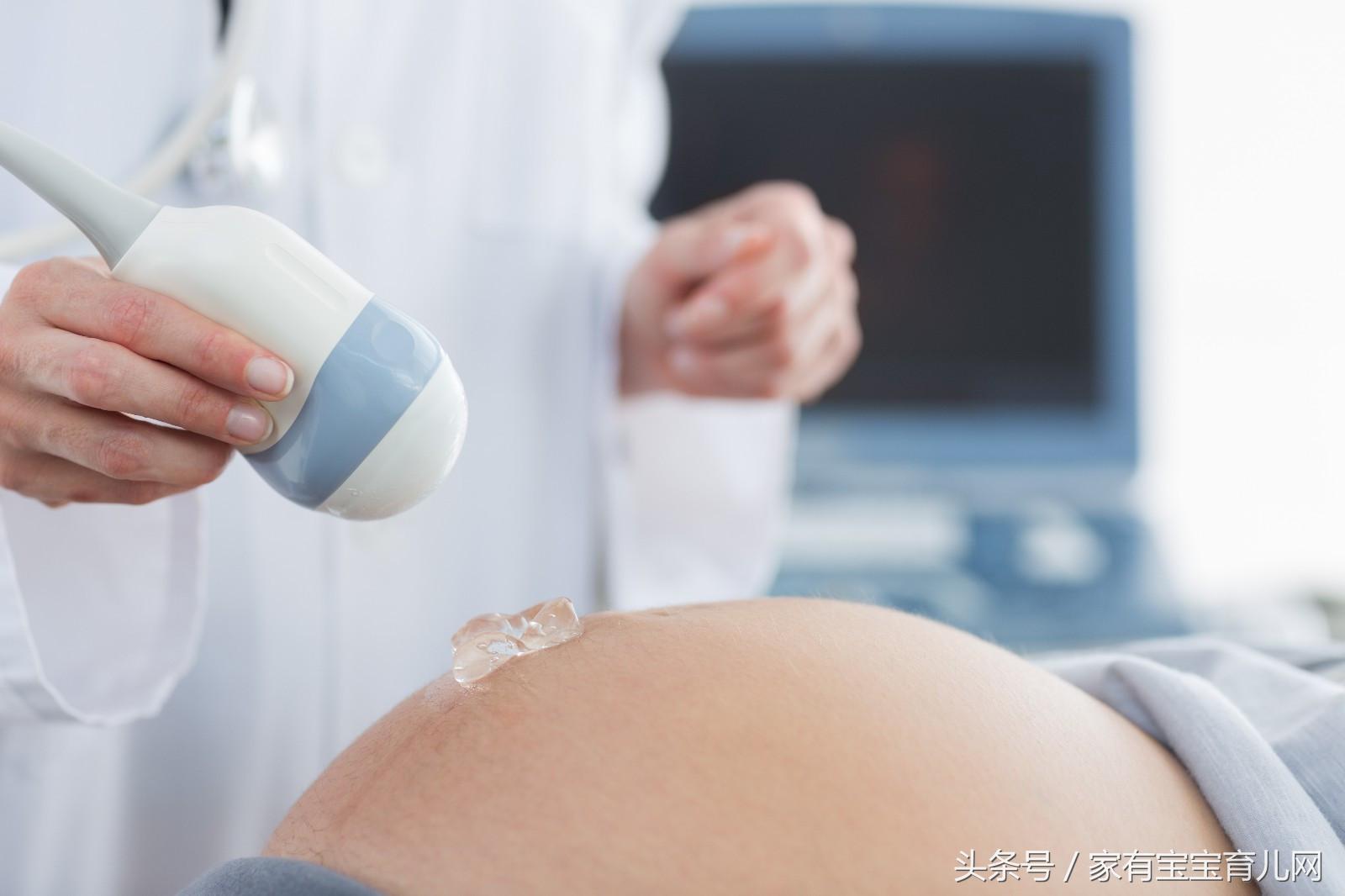 为什么胎儿突然没有胎心了,为什么胎儿突然没动了呢