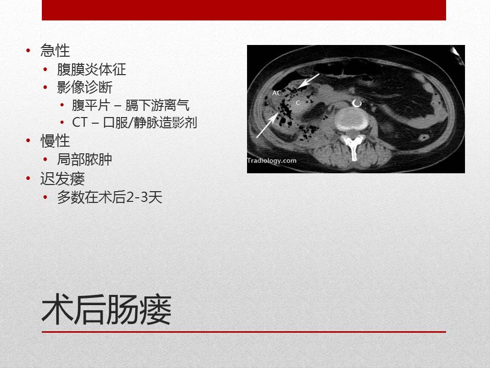 「图文+语音」刘明｜泌尿外科腹腔镜手术并发症的术中及术后处理