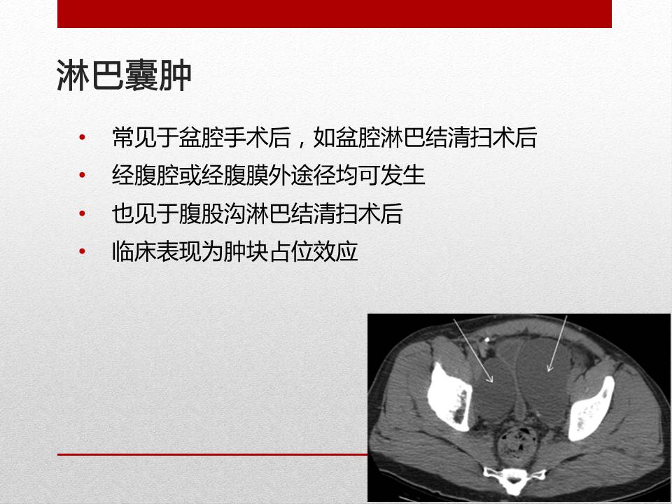 「图文+语音」刘明｜泌尿外科腹腔镜手术并发症的术中及术后处理