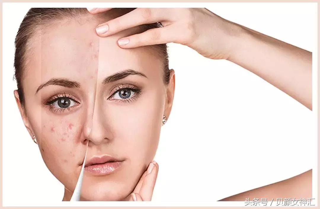 花了几千块美容,花了几十万护肤