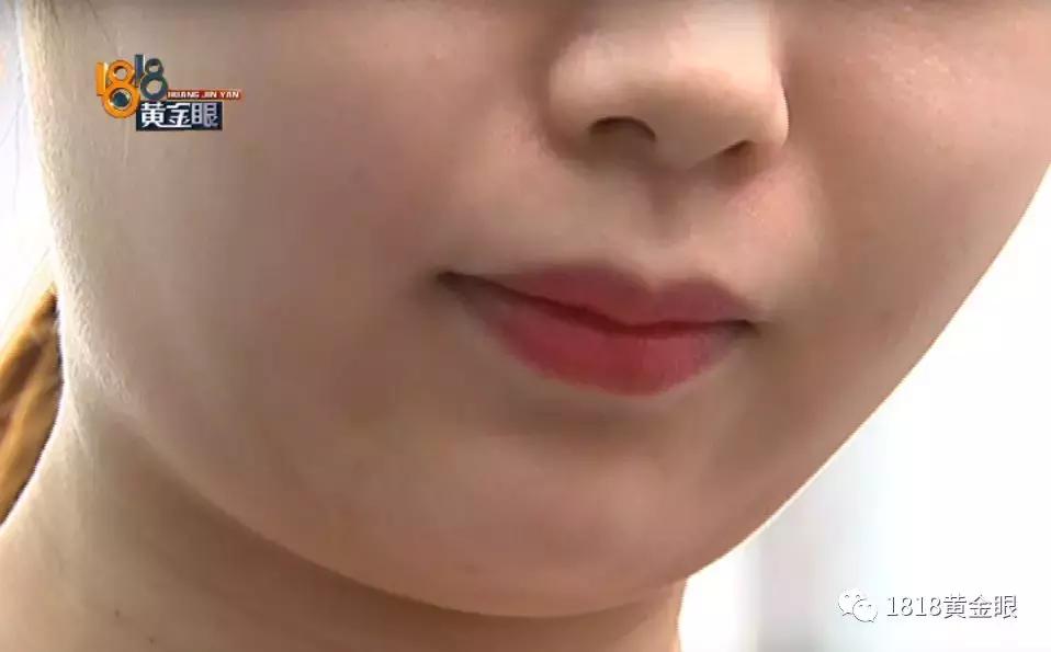 溶脂瘦脸4天了没有效果,花了1700打瘦脸针没效果