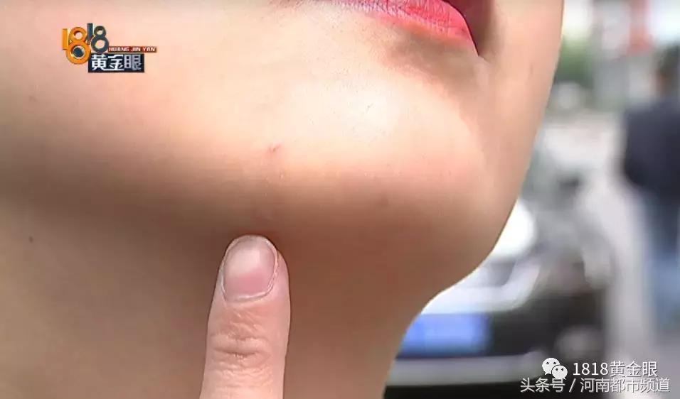 为什么我做溶脂瘦脸都没效果,为什么溶脂瘦脸15天才有效果