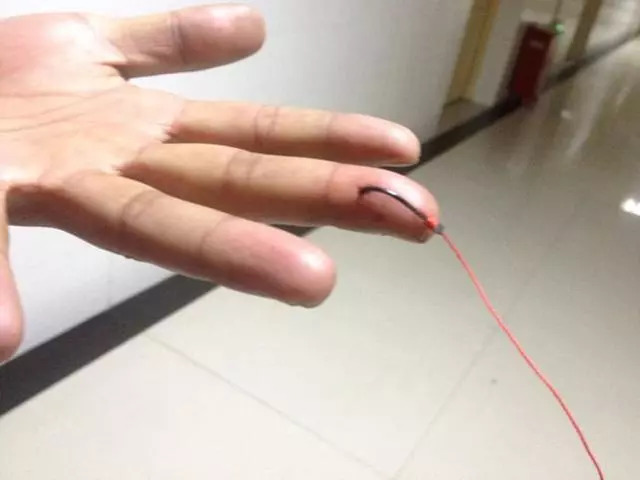 钓鱼遇到最痛苦的事情,钓鱼容易受伤吗