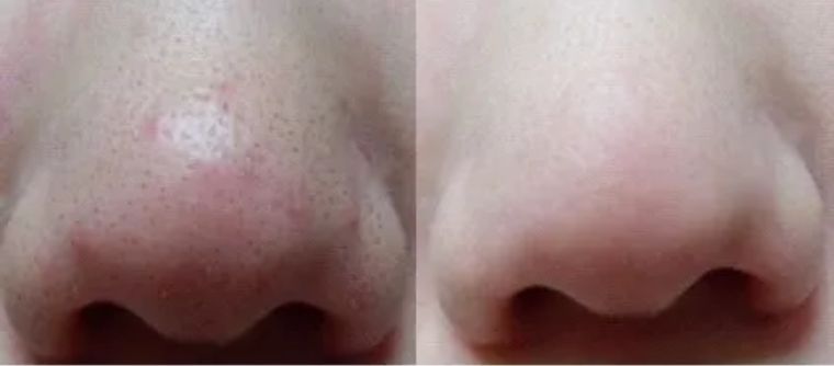 护肤品深层护理,几百上千护肤品有用吗