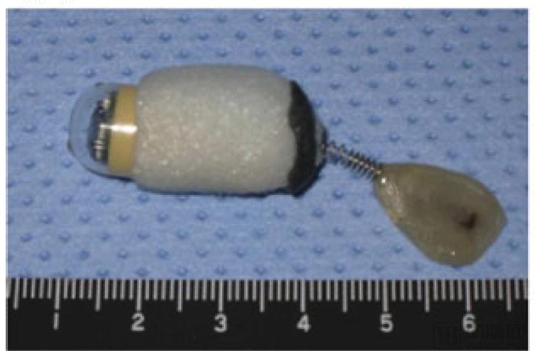 胶囊胃镜机器人市场前景,磁控胃镜胶囊未来发展方向