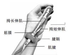 腱鞘囊肿有几种治疗方法,脚背上腱鞘囊肿怎么治疗