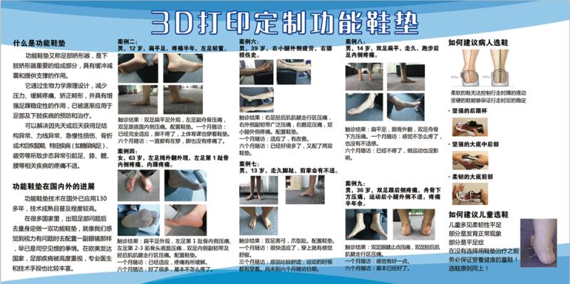 3D打印黑科技鞋垫脚不疼了,还防摔倒