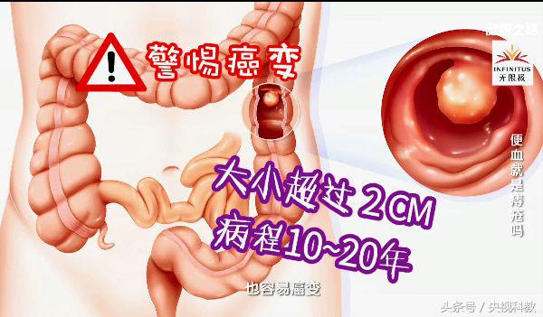 便血警惕六种病,便血最常见的原因及辨别方法