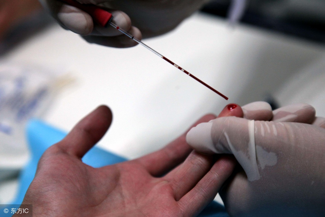 血常规化验单淋巴细胞低白细胞低,宝宝血常规化验单白细胞计数高