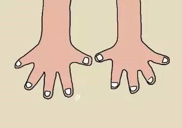 闷热潮湿引起的真菌感染,潮湿的环境能加重灰指甲吗