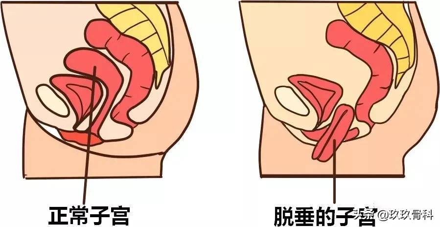 盆底肌有多重要这3点你应该知道,了解脏器功能