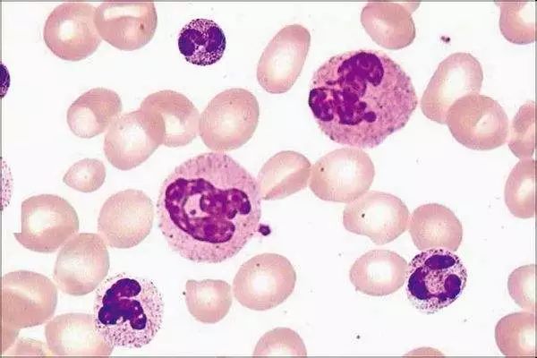 关于EGC身为铲屎官的你知多少?各种皮肤病都可能是EGC!