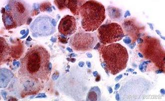 狂犬疫苗有副作用还要继续打吗,狂犬疫苗的副作用和注意事项