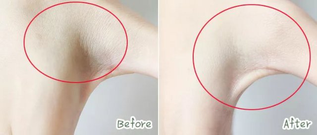 皮肤开裂使用护肤品多久自愈,泰国青草药膏能治皮肤干裂吗