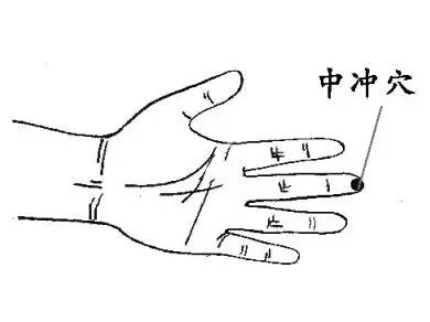 牙疼大便秘结失眠吃啥药,大便干燥牙疼失眠