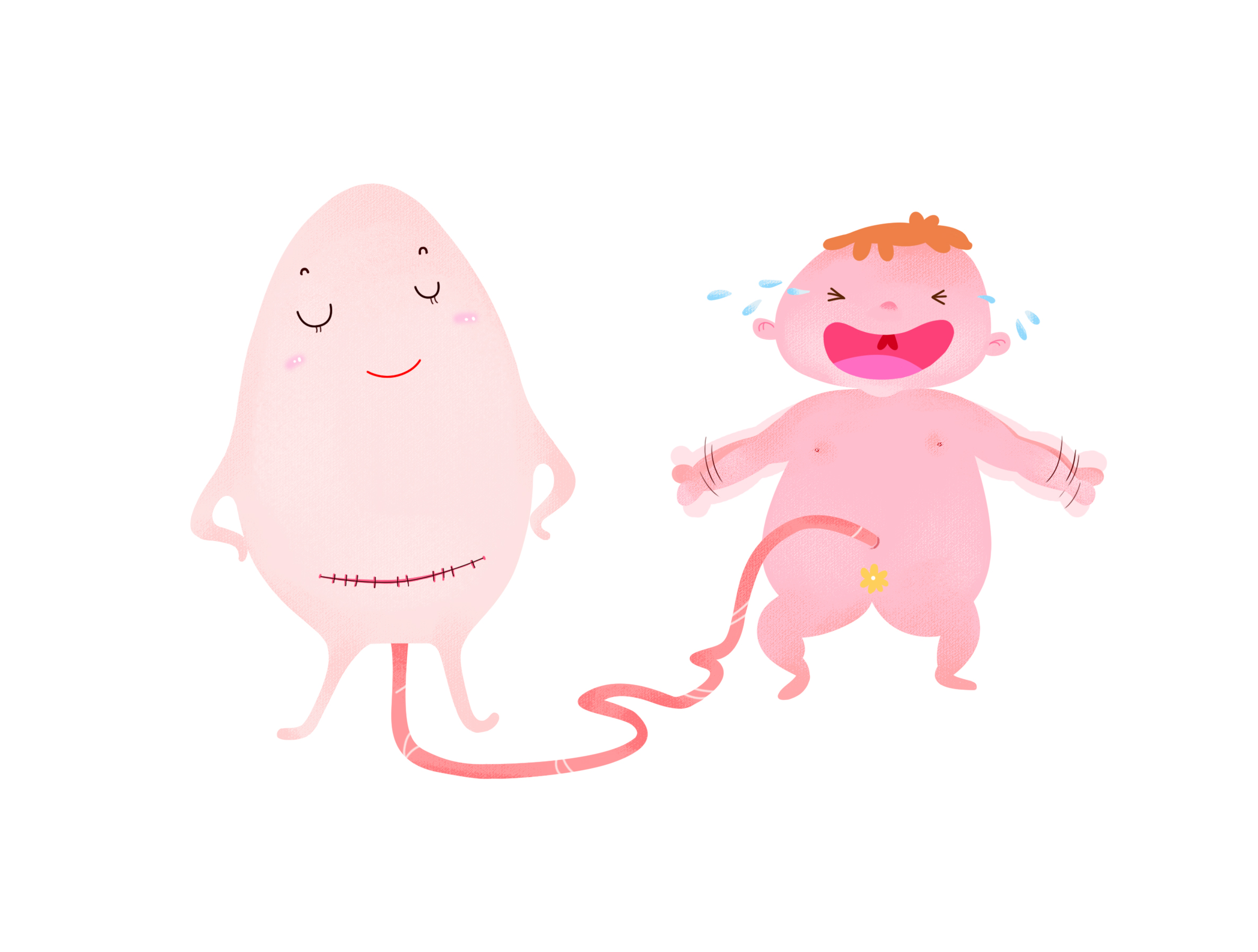 无痛分娩科普画,剖宫产术前宣教漫画