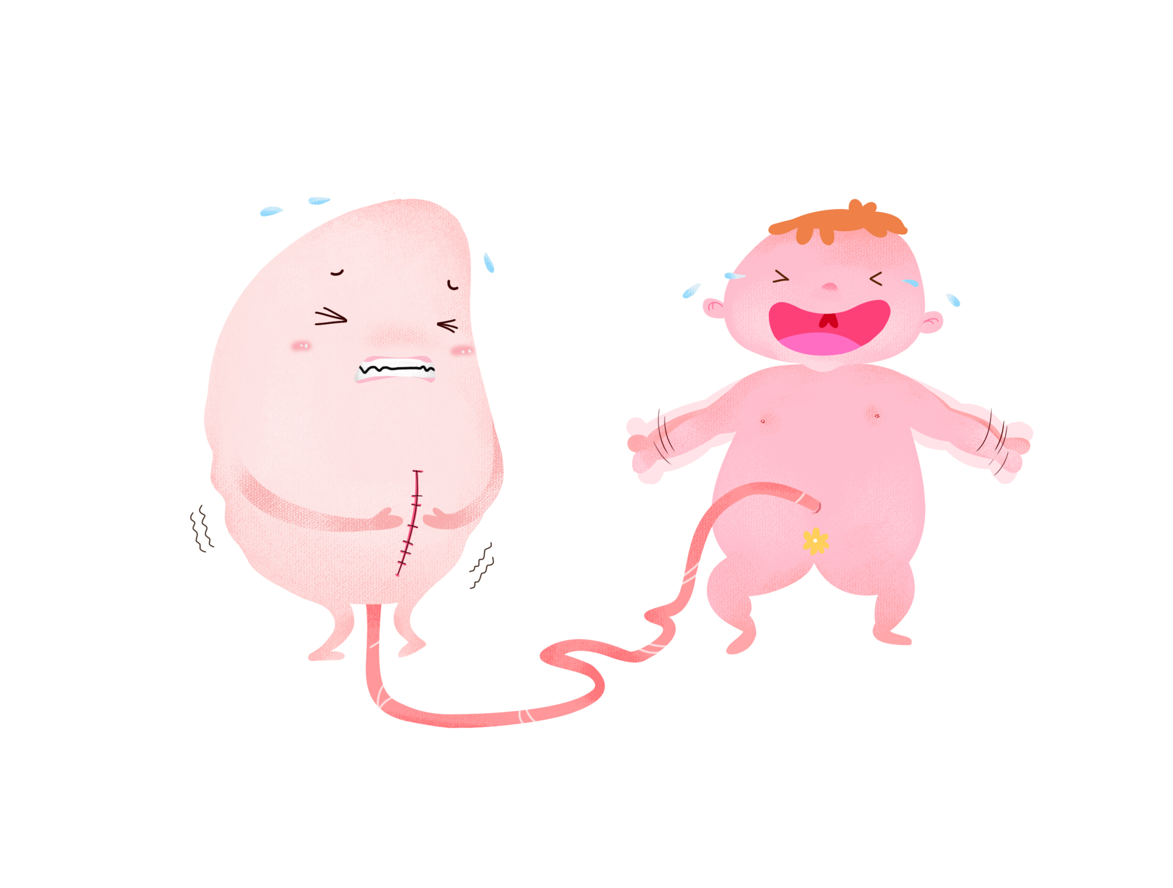 无痛分娩科普画,剖宫产术前宣教漫画