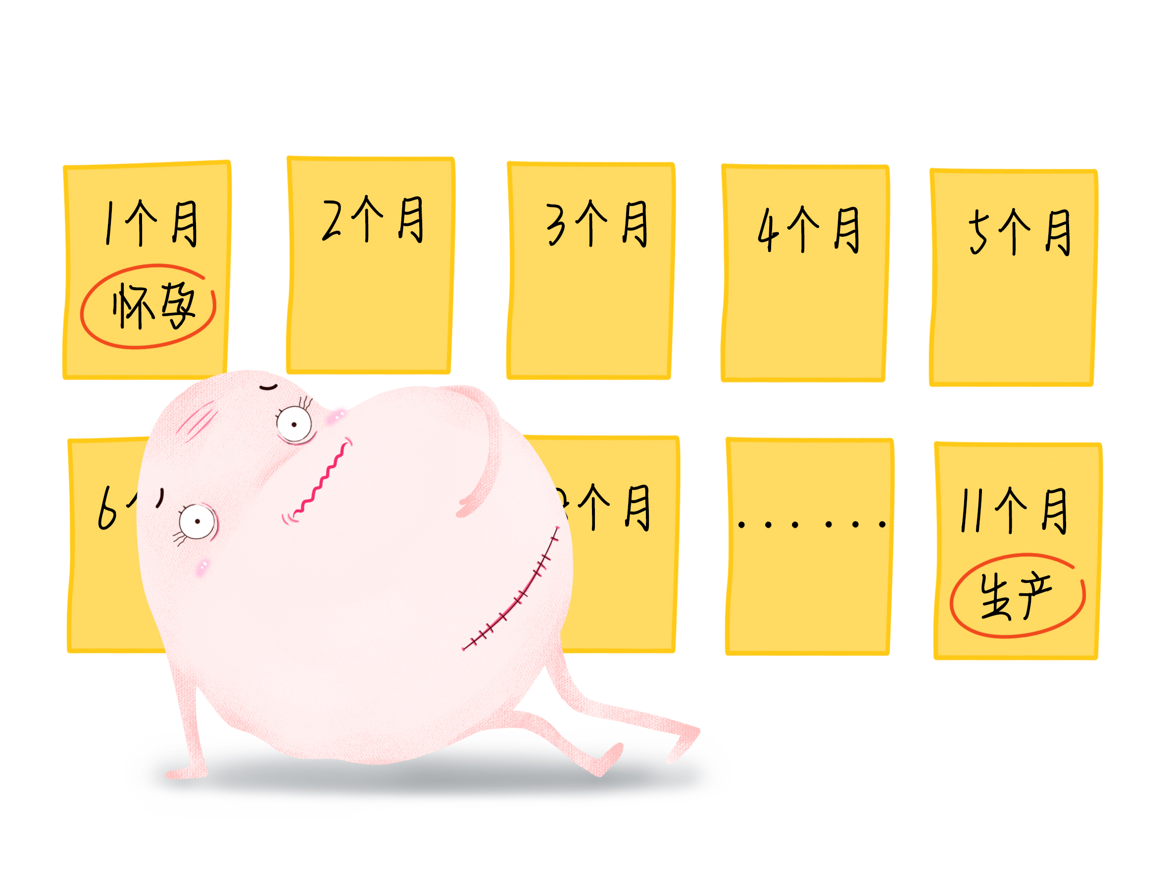 无痛分娩科普画,剖宫产术前宣教漫画