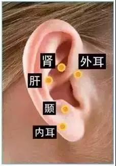 防治耳鸣耳聋重在细节,怎样预防耳聋耳鸣