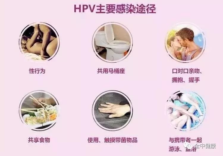 hpv感染到癌需要多久,hpv感染到宫颈癌都经历了哪些