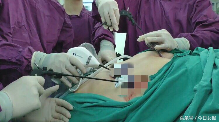 湖南第一胖,湖南最胖的人