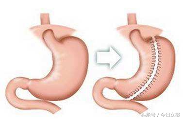 湖南第一胖,湖南最胖的人