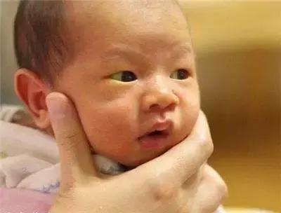 宝宝长湿疹咳嗽流鼻涕吃药也不好,小儿湿疹发烧最佳治疗方法