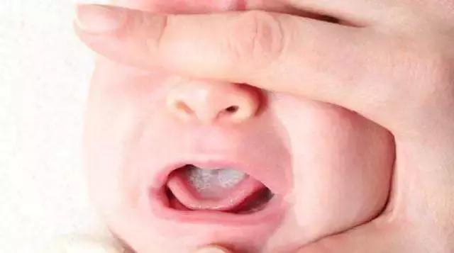 宝宝长湿疹咳嗽流鼻涕吃药也不好,小儿湿疹发烧最佳治疗方法