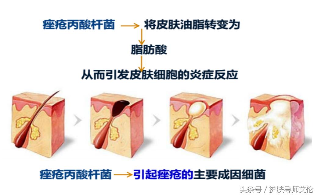 植物祛痘组合价格表,植物草本祛痘
