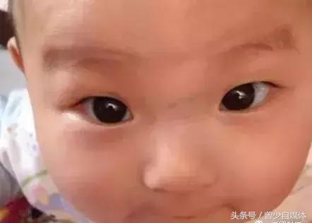 宝宝鼻梁有青筋真的比较难养吗,青筋难养鼻梁有青筋的宝宝