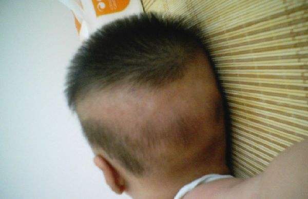 7个月宝宝缺钙的危险,7个月的孩子缺钙怎么补钙