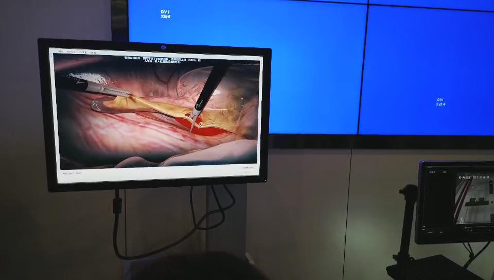 天堰：「让真实触手可及」
