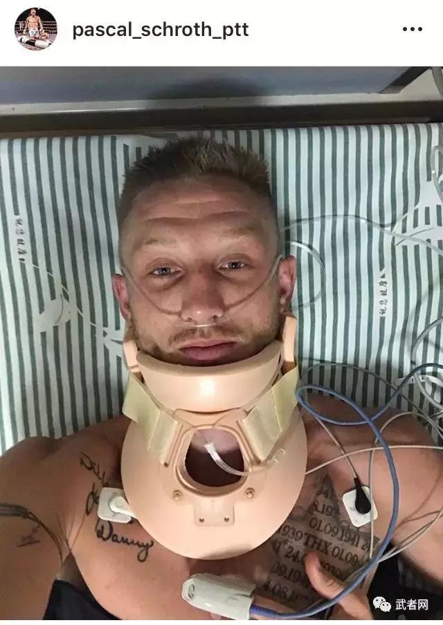 拳手擂台被打,擂台被掰断手臂还能比赛吗