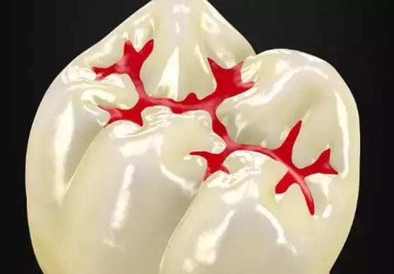 7岁女孩牙齿都是坏的怎么办,15岁孩子大牙龋坏一直不掉