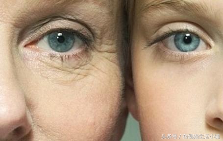 眼部有干纹眼霜推荐排行榜第一名,眼周细纹什么牌子眼霜好