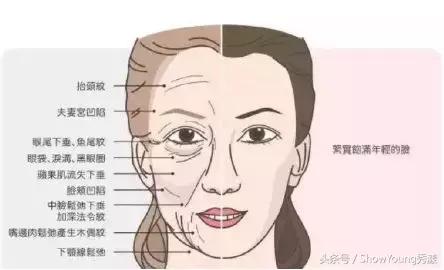 科普如何消除不同成因的法令纹,有法令纹与没有法令纹的区别