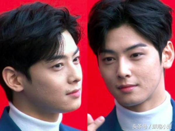 韩国漫画宣传片车银优,车银优脸爆痘图片