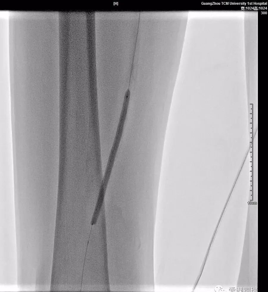 脚痛膝盖冷,脚痛腿发麻是怎么回事