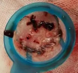 脚痛膝盖冷,脚痛腿发麻是怎么回事