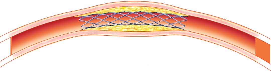 脚痛膝盖冷,脚痛腿发麻是怎么回事