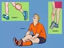 踝关节崴脚后期怎么解决,踝关节扭伤外翻崴脚