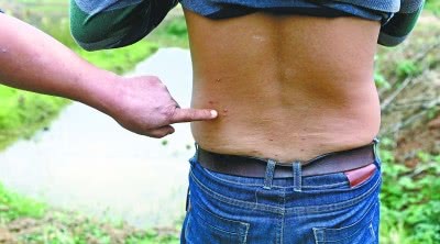 红蚂蚁咬人是怎么咬的,许多红蚂蚁咬人