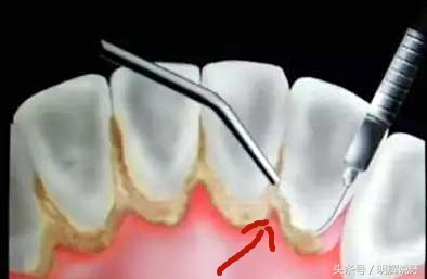 云南白药牙膏真的那么好吗,云南白药牙膏案件解决了吗